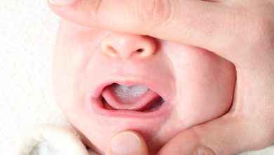 Photo of علت‌ برفک دهان در نوزادان + راه درمان